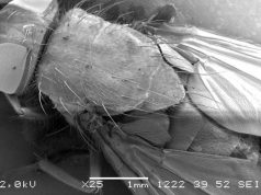 Imágenes increíbles ampliadas con un microscopio exposición el ojo electrónico